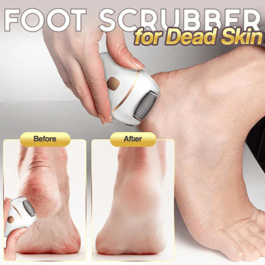 🔥LAST DAY PROMOTION SALE 52% OFF🔥Rechargeable Electric Foot Exfoliating Scrubber