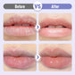🔥2026 New Arrivals: 50% Off for a Limited Time!🔥Plumping & Anti-Wrinkle Hydrating Lip Serum