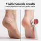 ⏳Time-Limited Special⏰Double-Sided Foot Scraper for Callus Removal