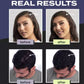 🔥Limited Time Promotion 50% OFF🔥Hair Building Fibers Set for Thinning Hair & Bald Spots